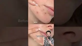 7 g&uuml;nde cilt değişimi videoları ger&ccedil;ek mi yoksa kandırmaca mı?