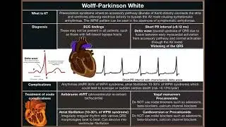 Wolff-Parkinson White 