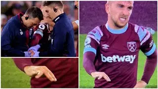 West ham star Jarrod Bowen suffered finger injury after scoring vs Wolves