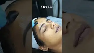Parvathy Parvathy | RF Face Lifting & Glow Peel | Maynee Cosmetology Clinic