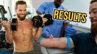 Carnivore Diet Results 6 Months Bloodwork with Saladino