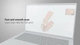 BLZ Dental INO200 Intraoral Scanner Introduction