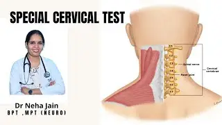 Cervical spurling Test & Distraction Test Neck pain & Cervical Radiculopathy Explained