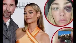 Denise Richards' Shocking Abuse Claims Against Aaron Phypers | Restraining Order Granted!