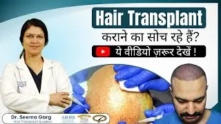 Hair Transplant के दिन क्या होता है? | Hair Transplant कराने से पहले जानिए Surgery Day का पूरा सच |