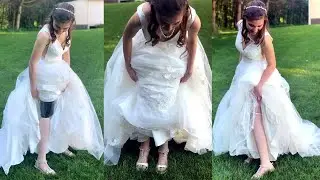 Why Double Amputee Wore Dress for 1st Time Ever at Wedding