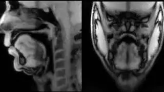 real-time MRI of whistling - All of me by Marks & Simons (1931)