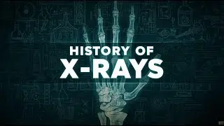 The Complete History of X-Rays | From Wilhelm R&ouml;ntgen to Modern Medical Imaging