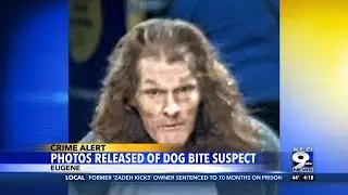 Photos Released of Dog Bite Suspect
