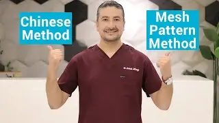 Chinese Method Hair Transplant | Mesh Pattern Hair Transplant | Dr. Jawad Jahangir | JJ Aesthetics