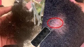PROTECTIVE STYLING GONE WRONG! PLEASE AVOID THIS! NATURAL HAIR HORROR STORY!
