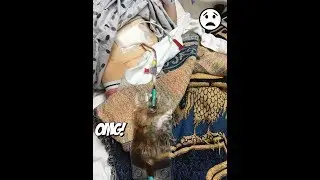 GJ TUBE PICC LINE PORT REMOVAL | UPDATE