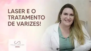 Laser e o tratamento de varizes!