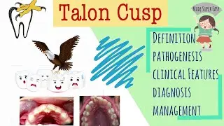 Talon Cusp I Developmental disturbances of teeth