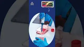 PathologySoftware| #smartreport with Easy to manage Laboratory Software| AdwingTechnologies