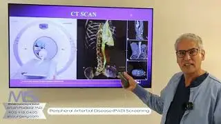 Peripheral Arterial Disease (PAD) Screening | Schedule Appointment (408) 918-0405