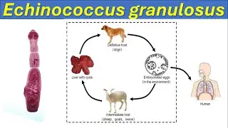 Life Cycle of Echinococcus granulosus: The Dog Tapeworms | Hydatid Cyst | Human Health