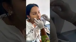 Dimple piercing #youtube #trending #youtubeshorts #viralvideo #shortvideo #shorts #short #piercing