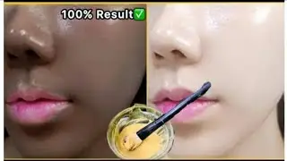 Best D'TAN Pack||Best Tan Removal Pack||Best Face Pack #glowingskin #glow #pigmentation 