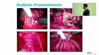 Alles &uuml;ber Prostatakrebs - Von der Diagnose bis zur Therapie | Tumortage Winterthur 2023