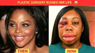 5 Black ACTRESSES Who Had Tragic Endings After PLASTIC Surgery 💔😱