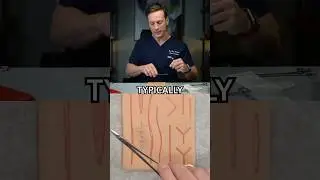 How to finish your run of simple stitches #surgeon #surgery #medicine
