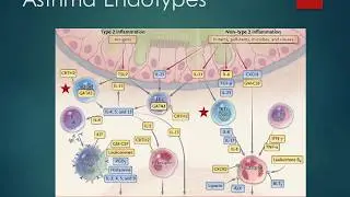 New Therapies for Severe Asthma 2018 Edward Omron MD, MPH, FCCP