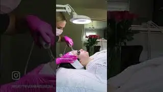 Peels we all love - @JoannaBojarska  @dermaquest-uk