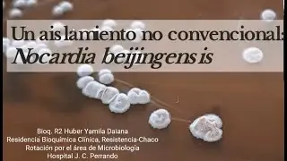 Un aislamiento no convencional: Nocardia beijingensis