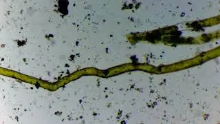 Vaucheria al microscopio  El alga que asombra por sus caracter&iacute;sticas