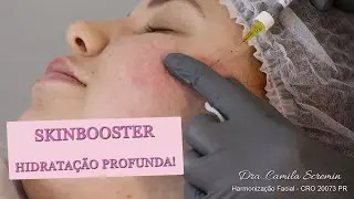 Tratamento para cicatriz de acne e hidratação da pele! Skinbooster - Pele Seca - Pele Hidratada