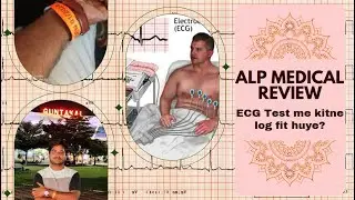Doubts on ECG test || ALP medical review ECG test || My Experience of ALP MEDICAL REVIEW