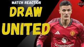 Another DRAW! Burnley 2:2 Manchester United! Match Reaction ! Man United News 