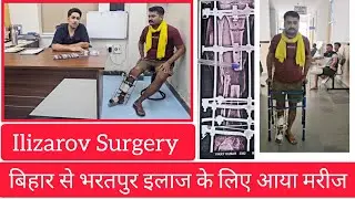 Ilizarov Surgery In Tibia and fibula bone Non-union fracture #ilizarovsurgery #fracturerecovery 