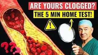 The 5 Minute Home Test That Detects Clogged Arteries Do This Tonight
