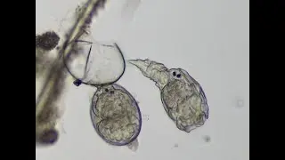 Rotifer Eggs hatching - Meet Eggifer and Bdella #microscopy #microscopy300years