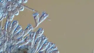 colonial stalked ciliates 200x DIC