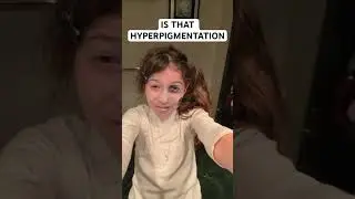 Hyperpigmentation makeup 😅 #hyperpigmentation #meme #sloppy #funny #shorts
