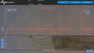 Pristionchus  pacificus and the NMX ScreenChip System