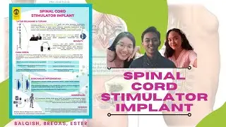 Spinal Cord Stimulator Implant