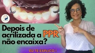 COMO AJUSTAR A PPR