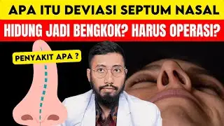 Deviasi Septum Nasal: Apa penyebabnya? Perlukah operasi?