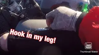 How to remove a hook from your leg!!