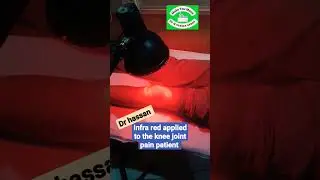 Infra red application to the knee pain patient.#kneepain #kneejointtreatment #trendingno1 #drhassan