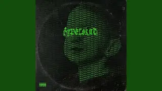 MISSEDCALLS (HYPERSKUT)