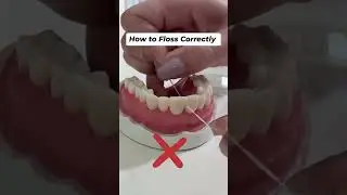 Floss #dentalcaries #dentist #smiledental #dentalclinic #dentalsmiledesigning #smiledentist