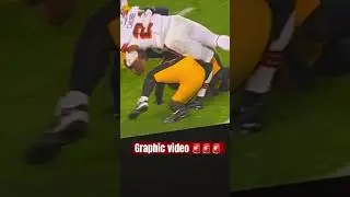 Nick chubb injury video