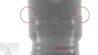 Implants with pumping effect