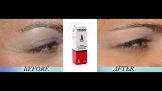Vitamin A Serum Oil Retinol anti acne anti wrinkles anti-aging