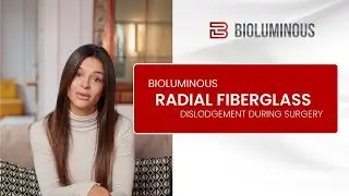 Radial Fiber Displacement: Key Causes Explained